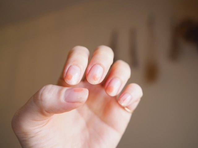 ネイルサロン　ネイル　爪育　爪　体質改善